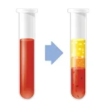 PRP غیر تزریقی