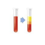 PRP غیر تزریقی